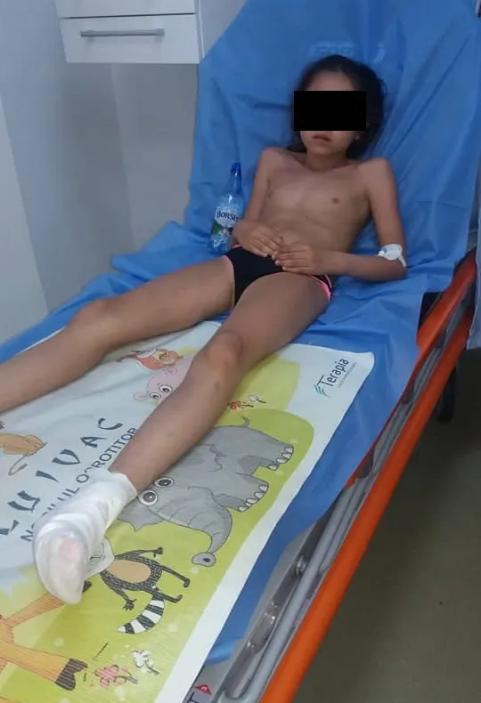 Incredibil! Copii cu tălpile arse de la toboganul de la piscină