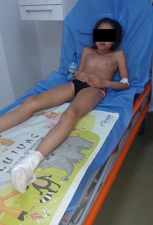 Incredibil! Copii cu tălpile arse de la toboganul de la piscină