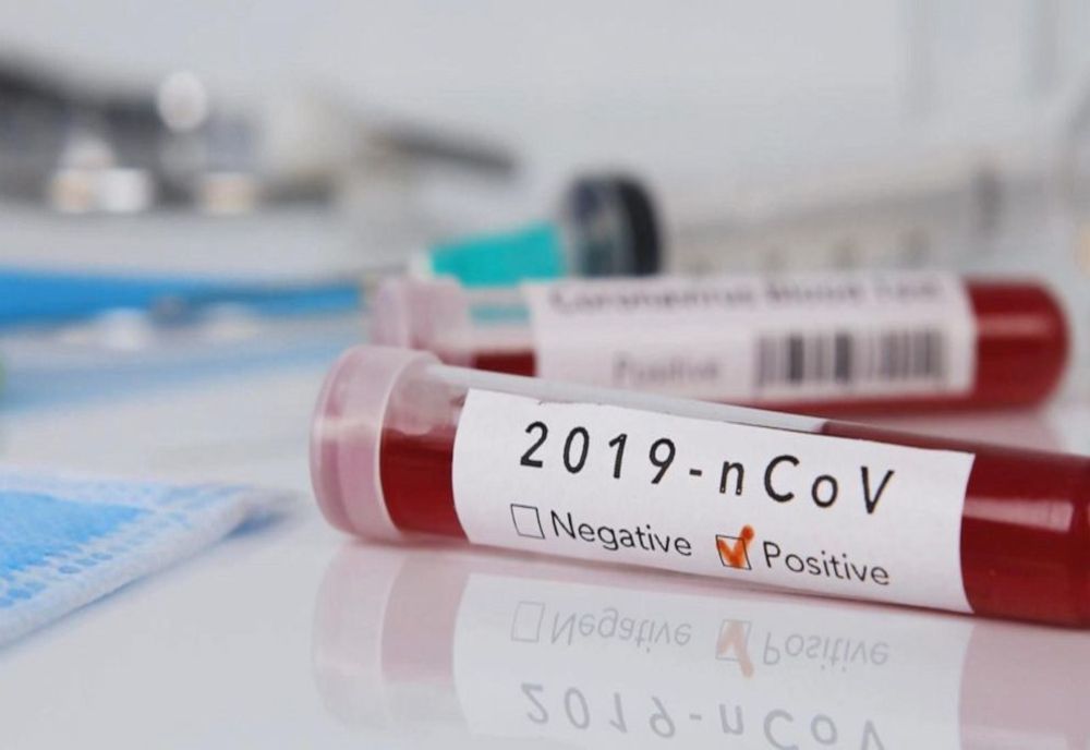 Coronavirus România: A crescut numărul celor infectați cu CoVid-19, la 762! Șase pacienți, în stare foarte gravă