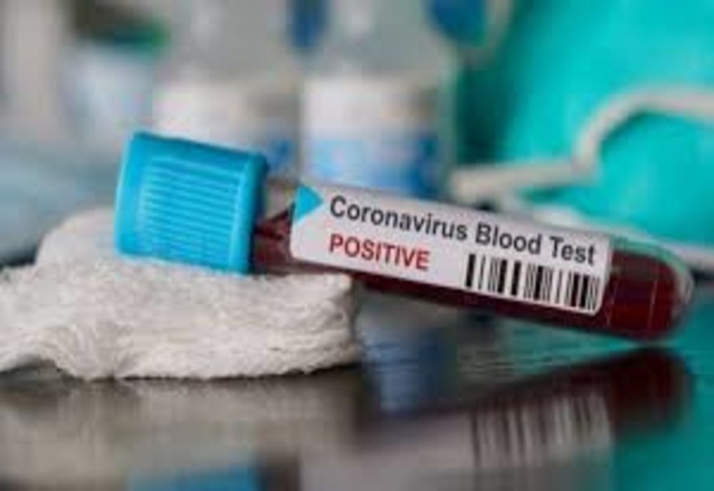 Autoritățile au anunțat cu puțin timp în urmă noi decese în România, ca urmare a infecției cu coronavirus. Bilanțul deceselor în România - 203 