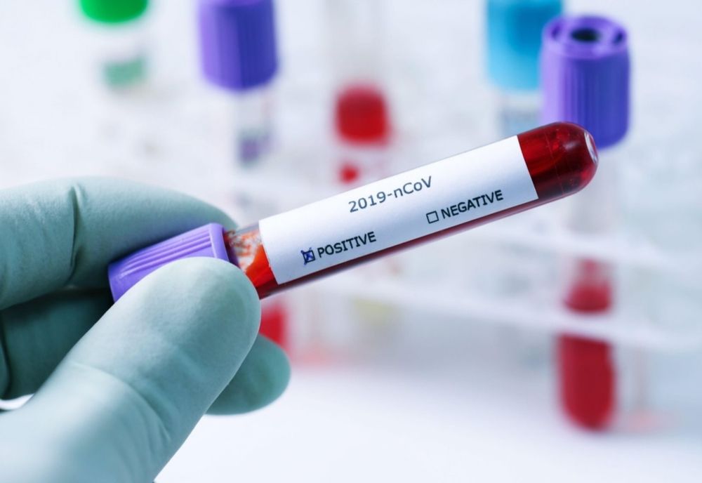 Bilanț coronavirus 23 decembrie: 775 cazuri noi și 81 decese dintre care 44 anterioare