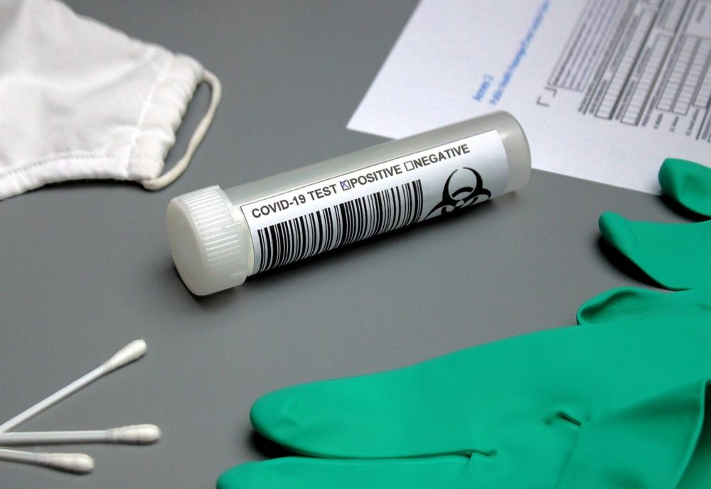 Bilanț coronavirus 5 februarie: 28.921 cazuri noi și 108 decese
