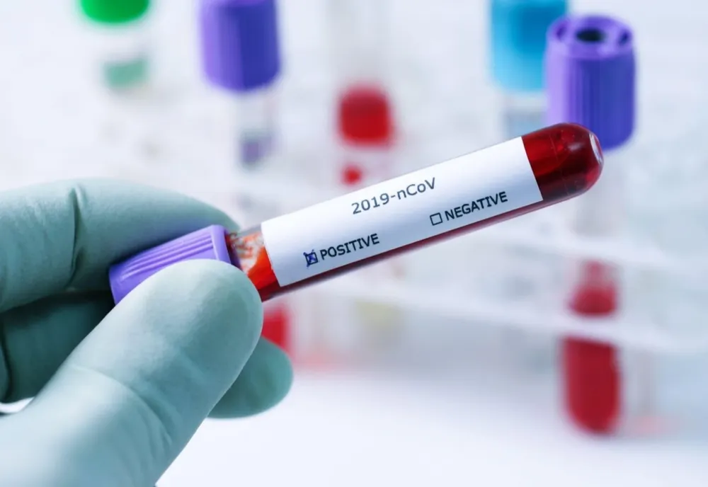 Bilanț coronavirus 06 decembrie 2021: 803 cazuri noi și 54 decese