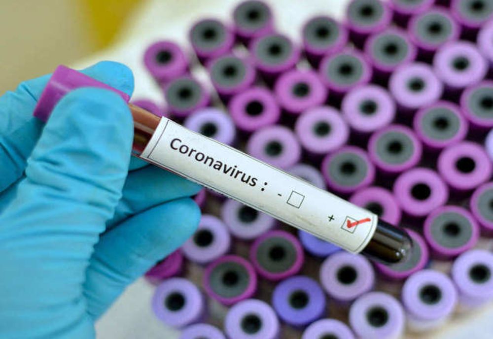 Numărul cazurilor de persoane infectate cu COVID-19 în România a depășit pragul de 20.000