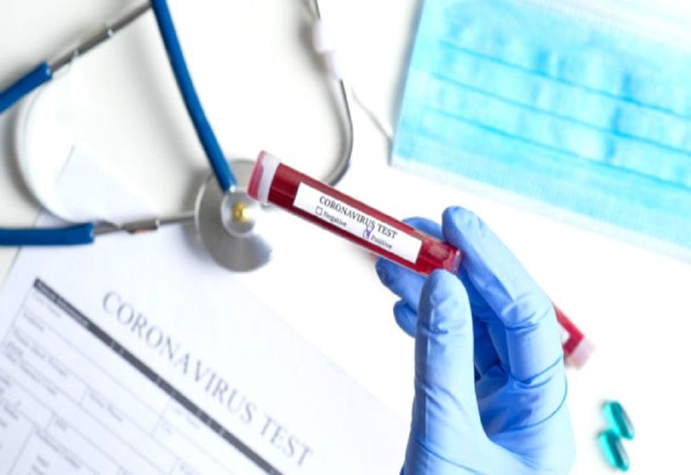 Laboratorul de analize medicale din Hemeiuş poate procesa 1.000 de probe pe zi pentru COVID-19