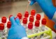 Un nou deces cauzat de infecția cu coronavirus, a fost raportat în Bacău
