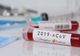 Coronavirus România: A crescut numărul celor infectați cu CoVid-19, la 762! Șase pacienți, în stare foarte gravă