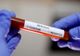 CORONAVIRUS ROMÂNIA - Noul bilanț, anunțat de autorități - 8.746