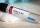 Bilanț coronavirus 25 noiembrie: 2.104 cazuri noi și 212 decese dintre care 35 anterioare